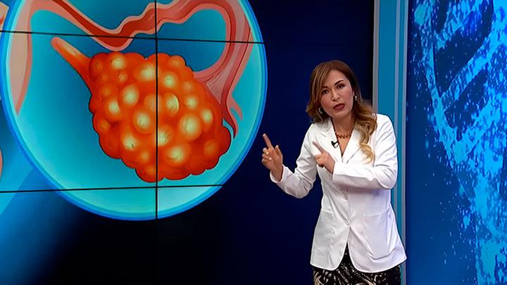 Consecuencias de la TBC 